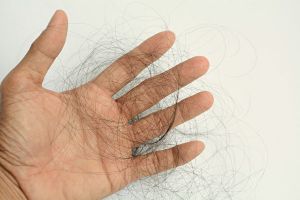 減少落髮的養髮三步驟：一洗二吃三睡