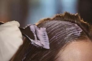 反覆染髮 頭皮發炎