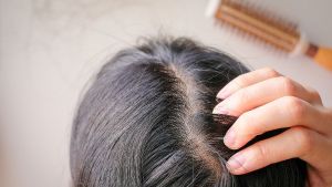 這8個問題會導致頭髮脱落