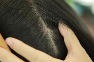 瞭解頭皮健康 掌握養髮關鍵5大重點