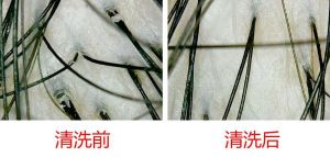 想擁有豐盈潤澤秀髮 頭皮清潔很重要