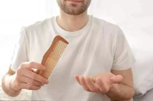 壓力大 導致青年人雄性脱髮提早出現