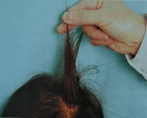 年輕人為掉頭髮煩惱 每天掉多少頭髮才算脱髮