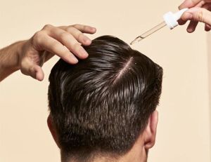 治脱髮亂用偏方 治不好 更容易禿