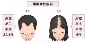 女性也有雄性脱髮 多開始於30至40歲間