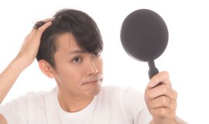 造成髮際線後退的八大原因!