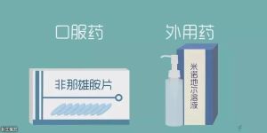 新生植髮：米諾地爾脱髮更嚴重嗎?用藥一定要看