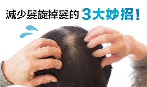 減少發旋掉髮的3大招! ～克服發旋掉髮看這裏～