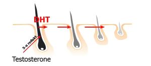 生物素能減少二氫睾酮嗎？