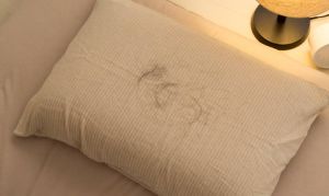 後枕部脱髮的原因 後枕部脱髮的改善對策