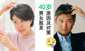 40歲男女脱髮的原因及對策