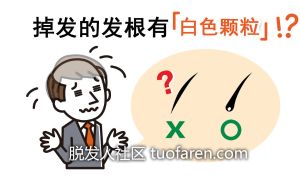 掉髮的髮根帶有白色顆粒怎麼辦! ?原因與對策大解析!