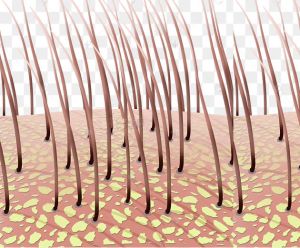 6種精油幫助去除頭皮屑