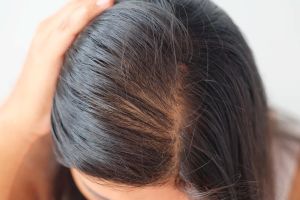 為什麼隨着冬天的臨近，頭髮越掉越多？