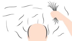 兒童和青少年脱髮的模式、原因和解決方案是什麼？