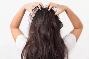 兩天沒洗頭了，頭皮有點刺痛……