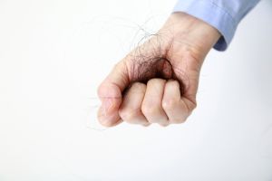 脱髮的原因和預防