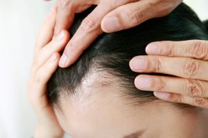 防止脱髮的“最重要”習慣是什麼？