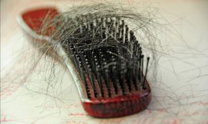 劉海脱髮的原因及預防