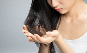 我不能吃脱髮藥...如何治療女性脱髮？
