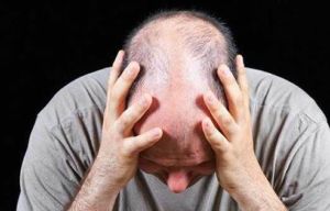 怎麼準確判斷自己是否脱髮了？