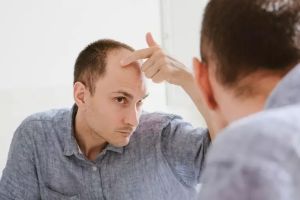 預防脱髮——如何有效阻止脱髮