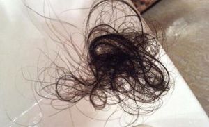 新生植髮：同樣是掉頭髮，為什麼自己的頭髮越掉越少