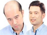 鼎尚风彩织发补发