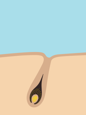 頭髮從哪裏生長出來的