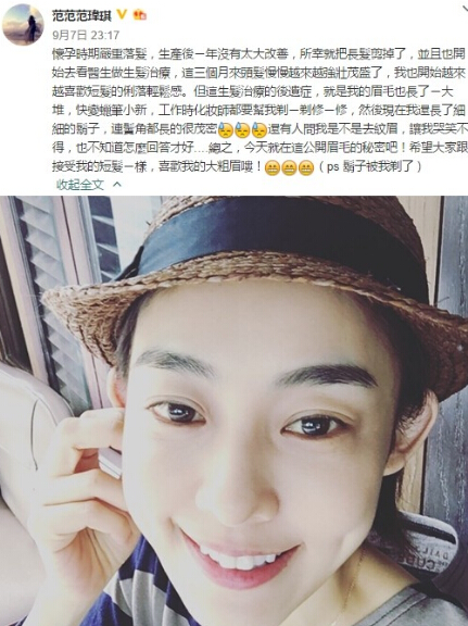 范瑋琪2015年產後脱髮
