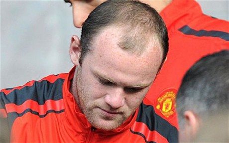 wayne-rooney-hair.jpg