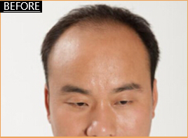 金髓生发液 金髓生发液