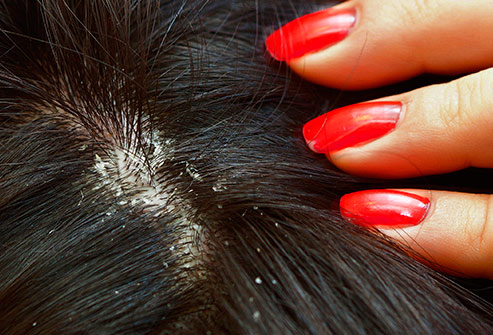 不經常洗頭 不經常洗頭