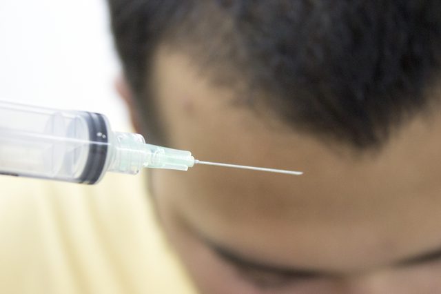 皮質類固醇 皮質類固醇