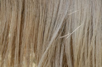 前額頭髮移植 前額頭髮移植