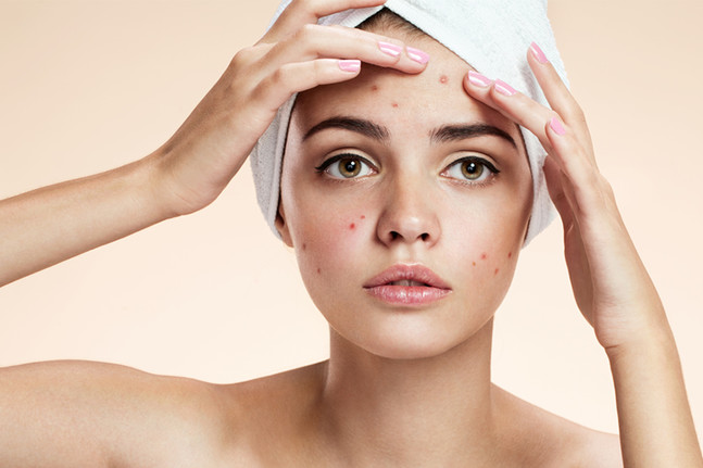 蘋果醋治療痤瘡 蘋果醋治療痤瘡