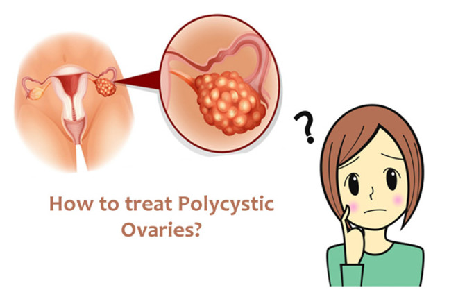 蘋果醋治療多囊卵巢綜合徵 蘋果醋治療多囊卵巢綜合徵