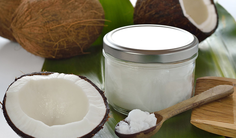 椰奶油——治療雄激素性脱髮 椰奶油——治療雄激素性脱髮