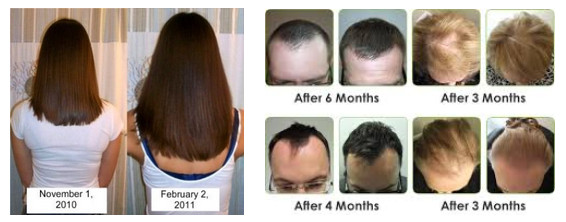 服用生物素後的對比圖 服用生物素後的對比圖