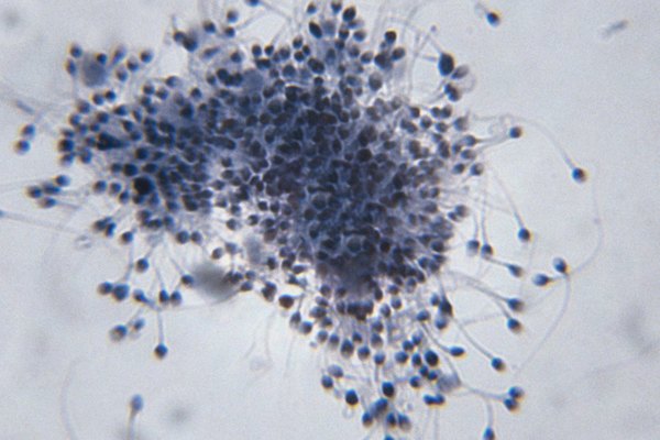 人體精子的顯微圖像 人體精子的顯微圖像