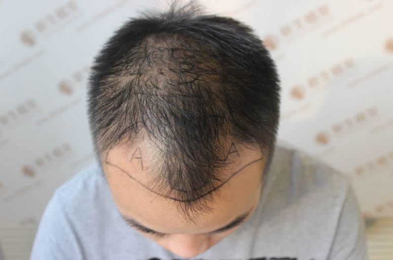 1597330594416086296.jpg 1.jpg