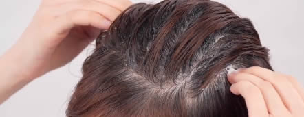 頭皮去角質的步驟2 頭皮去角質的步驟2