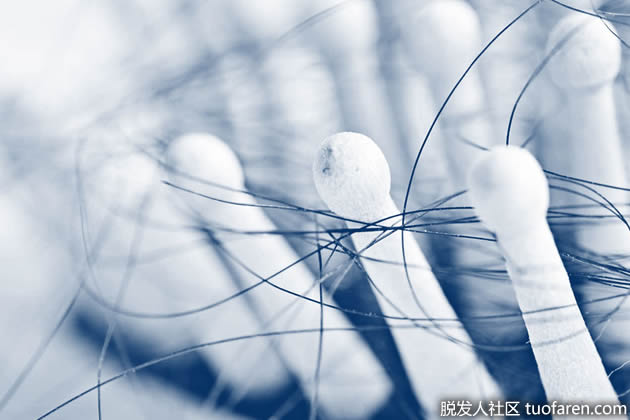 瀰漫性脱髮在家治療 瀰漫性脱髮在家治療