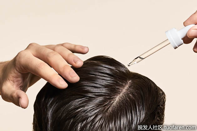 米諾地爾 米諾地爾