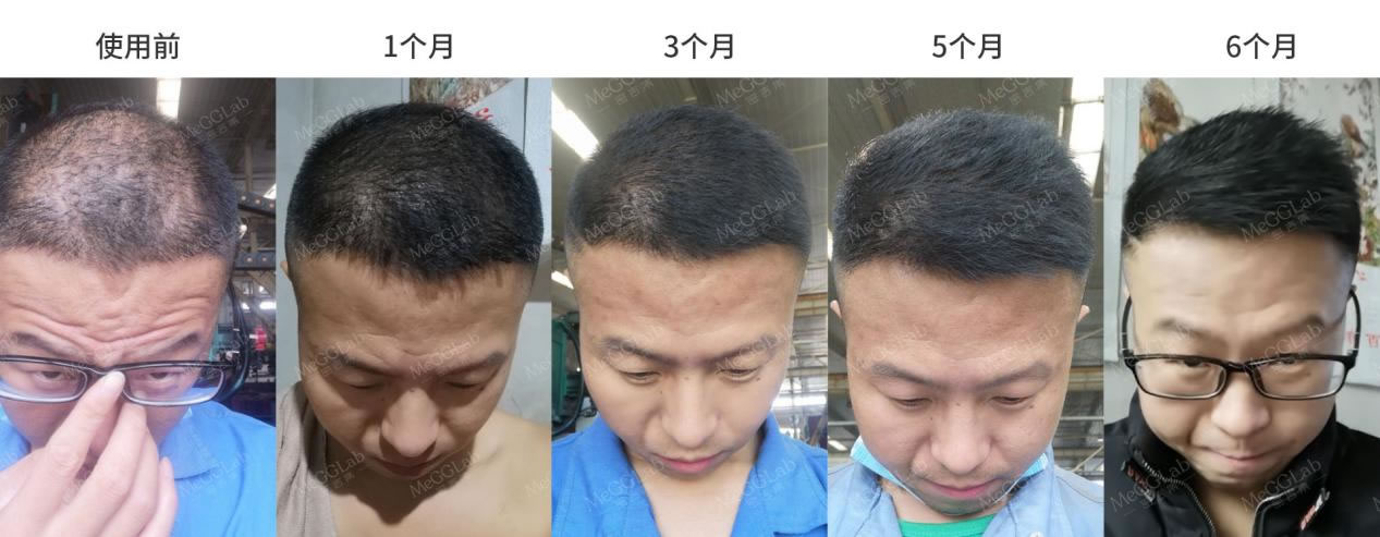 米諾增效_效果圖1 米諾增效_效果圖1