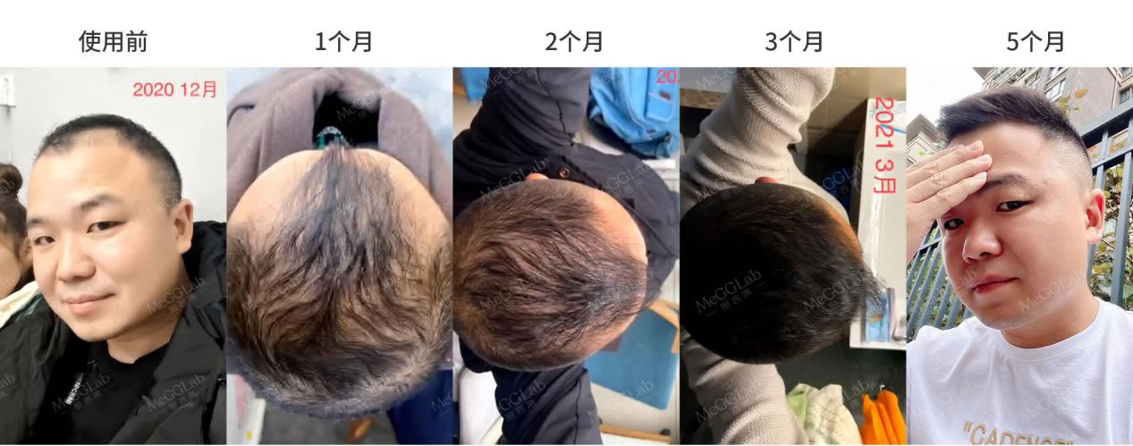 米諾增效_效果圖2 米諾增效_效果圖2