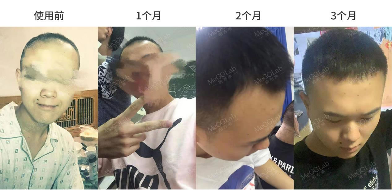 米諾增效_效果圖3 米諾增效_效果圖3