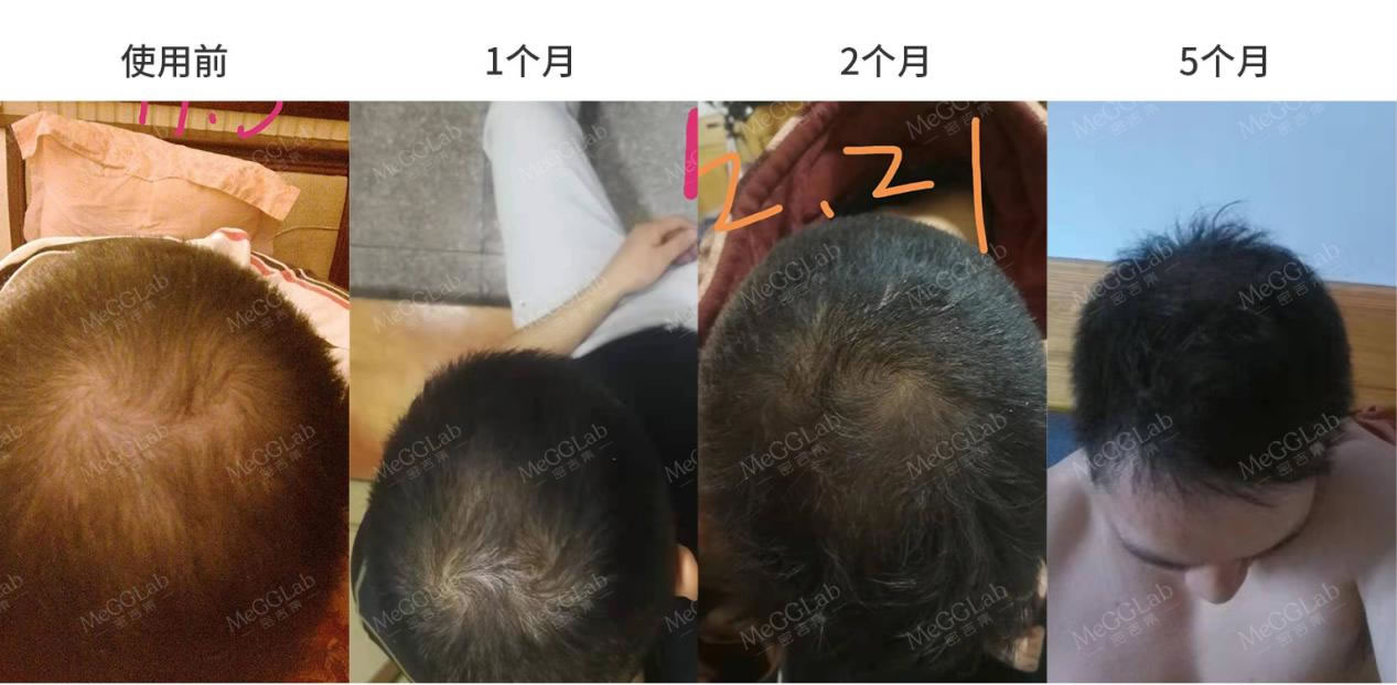 米諾增效_效果圖4 米諾增效_效果圖4