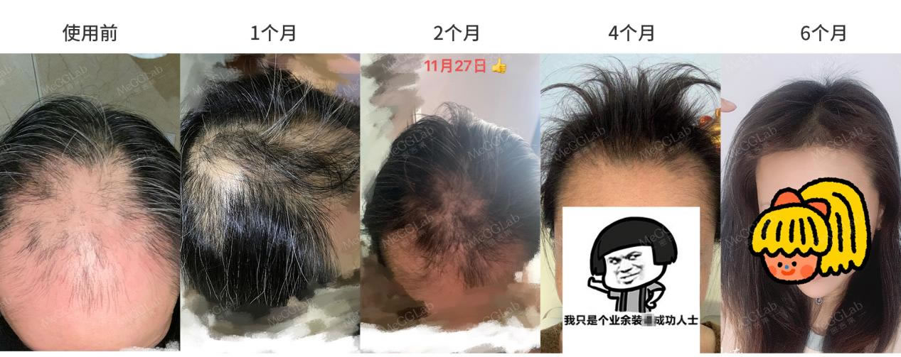 米諾增效_效果圖5 米諾增效_效果圖5