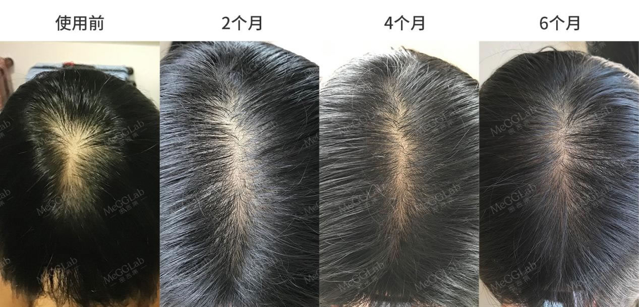 米諾增效_效果圖6 米諾增效_效果圖6